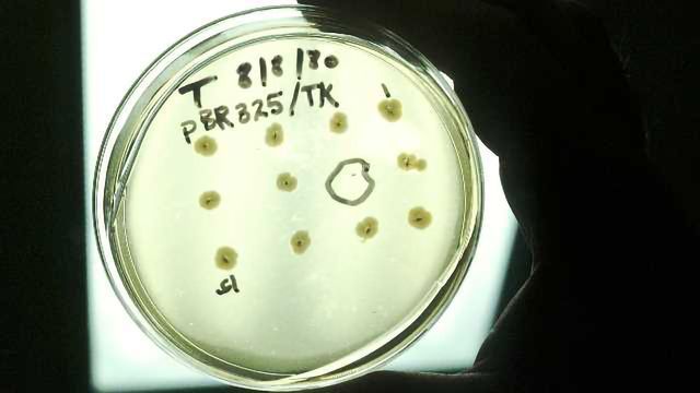 6 Innovative Applications of Microbes content piece image 