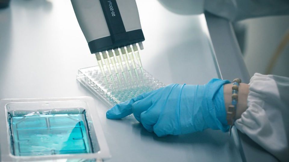 An Introduction to the Enzyme-Linked Immunosorbent Assay – ELISA Test content piece image