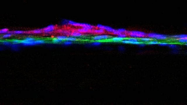 Breakthrough Model of Human Kidney Developed content piece image 