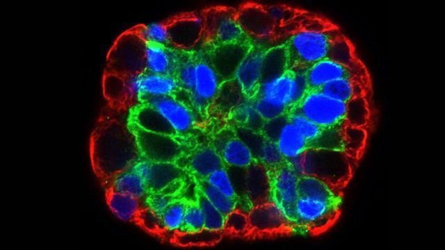 How Organoids Are Fueling Infectious Disease Research and Personalized Medicine content piece image 