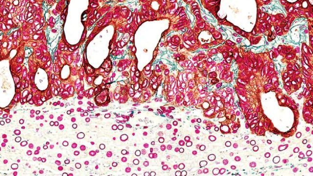 Immunohistochemistry Guide content piece image 