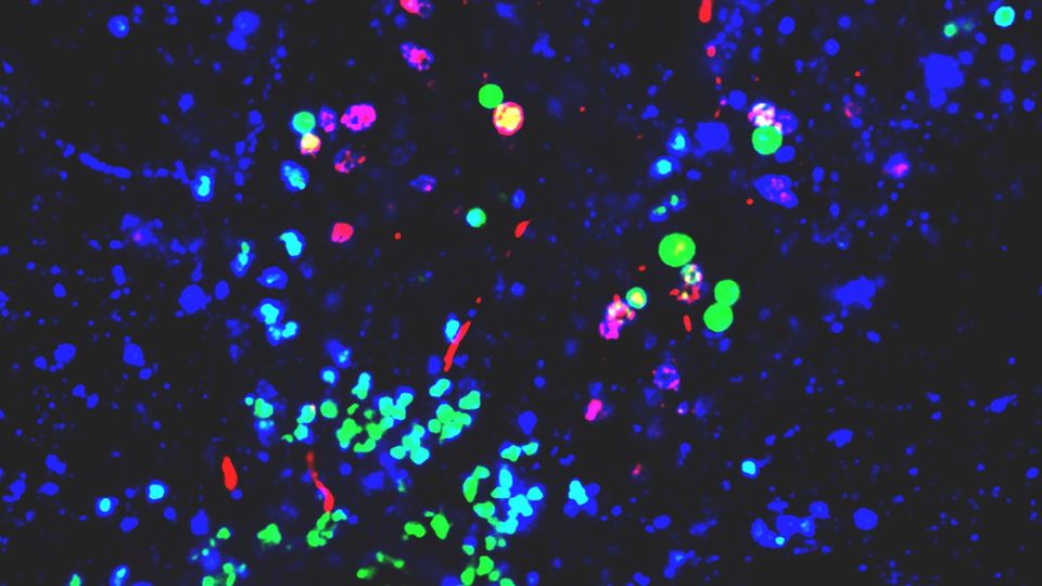 Colored nanoparticles under a microscope.